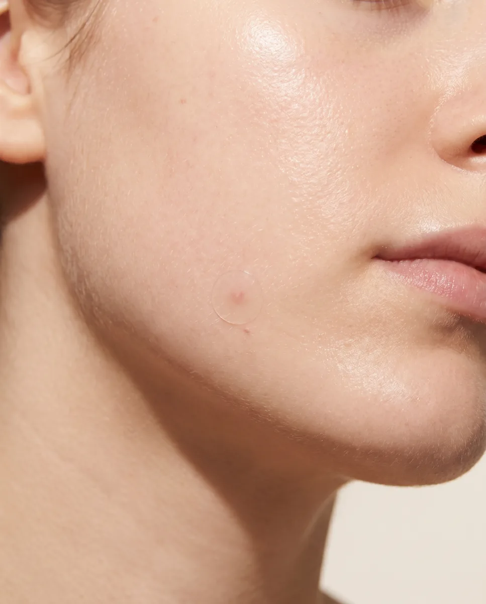 blend patch invisible on skin